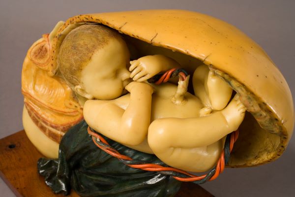 fig. 18 - Luigi Caiani - Un neonato a termine - cera 1888.jpg